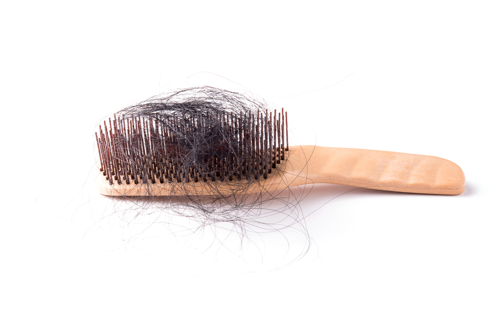 Saç Dökülmesi ve Tedavisi